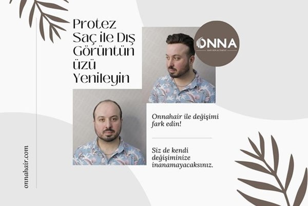 Protez Saç ile Dış Görüntünüzü Yenileyin